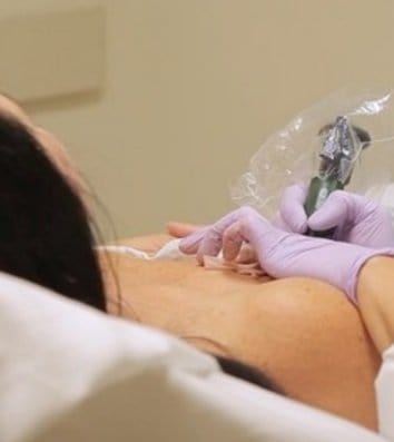Areola RE- pigmentation