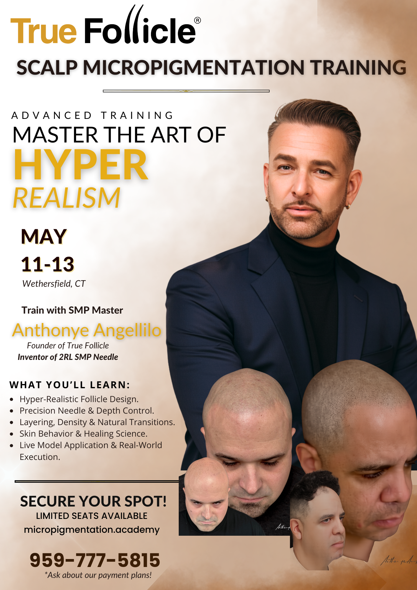 Scalp Micropigmentation Wethersfield, CT (MAY 11-13)